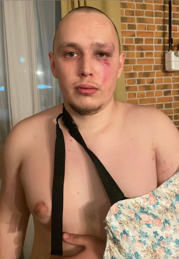 Олексій Іванін, якого побили охоронці лікарні на Київщині / © 24 канал